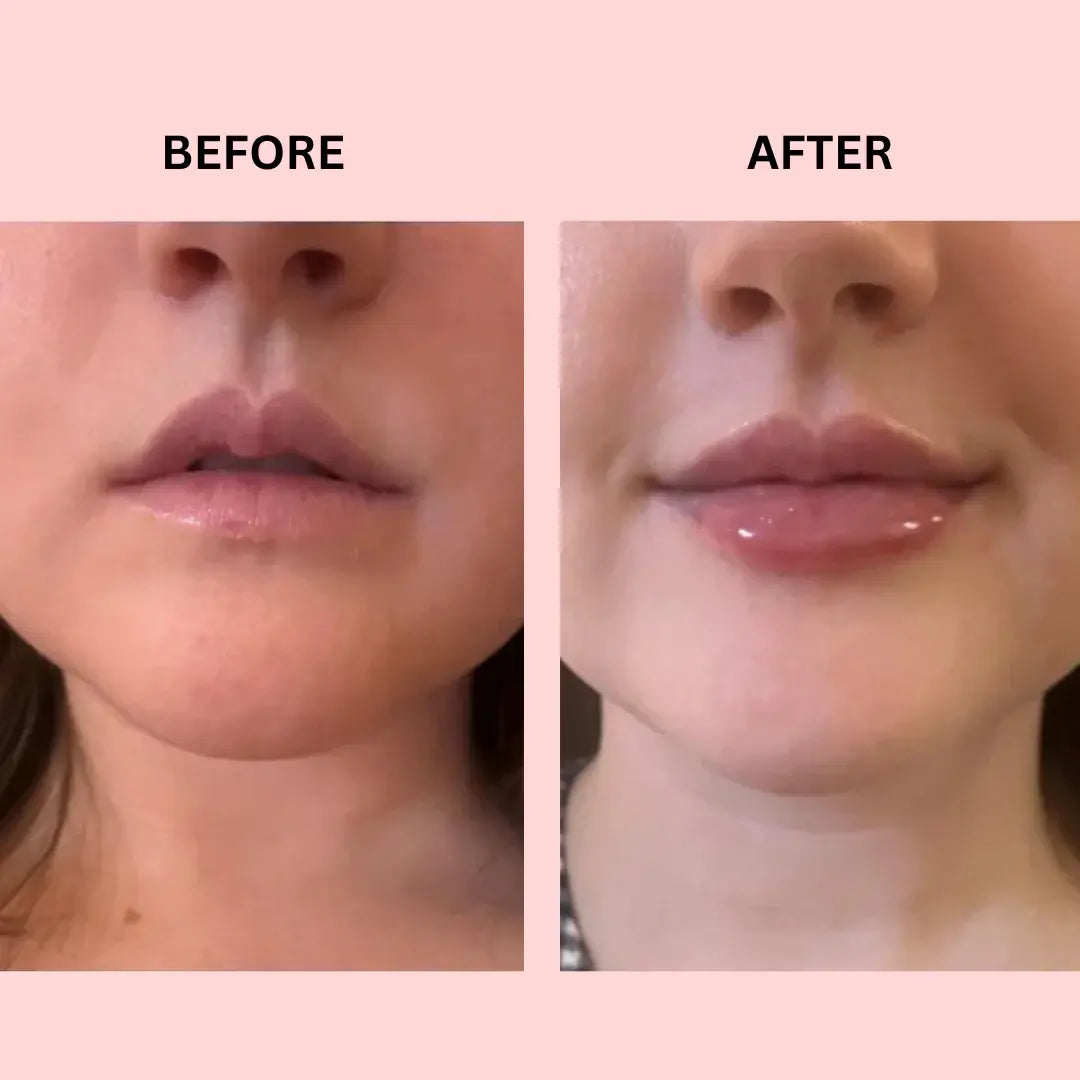 LIPBOOST
